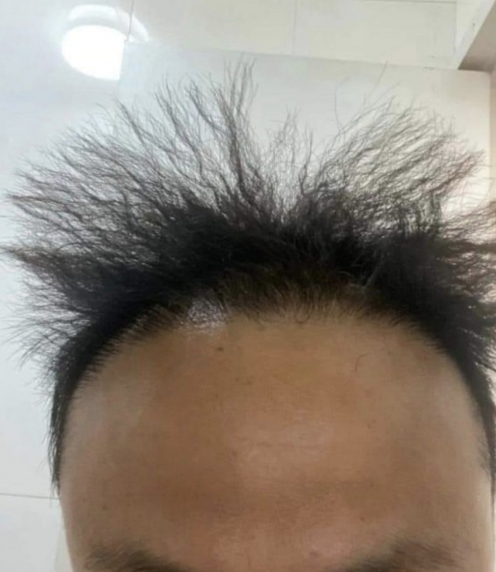 而樓主嘅電髮成果亦非常顯著！