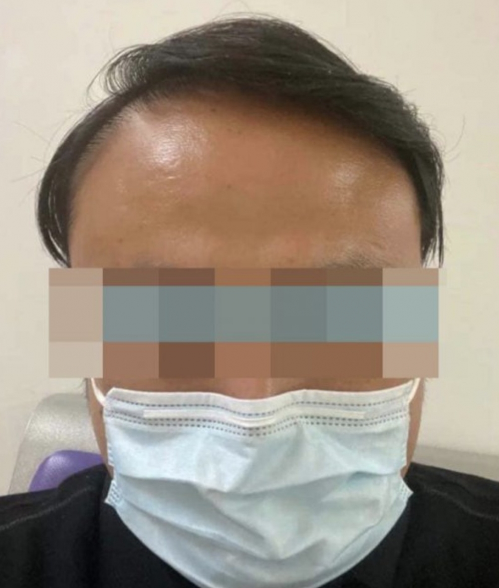 港男於群組中向大家分享自行電髮嘅經過！