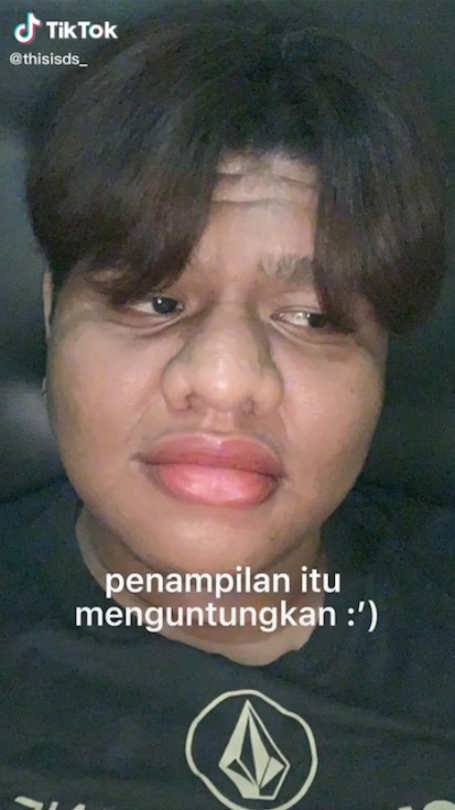 Oddi以前臉色不好，臉部多肉。