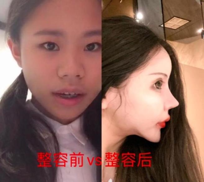 小z娜娜公開自己原本樣子卻被唔少網友指比依家個樣更好睇。