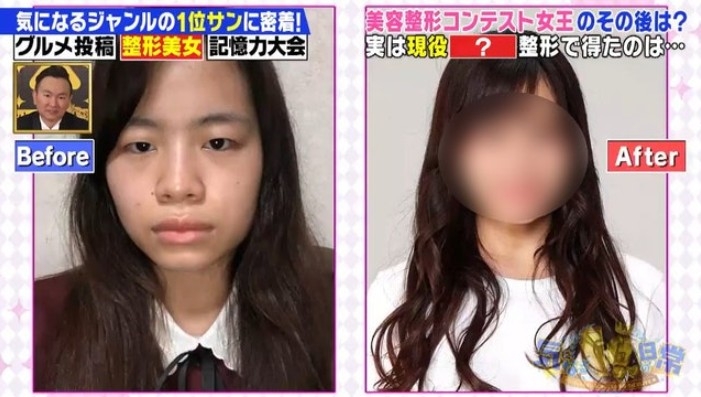 日本地下偶像尾上七海整形後大大改善了人生?