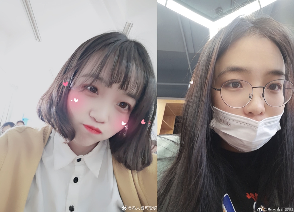 有做審計業女生表示,上班後出現脫髮問題。