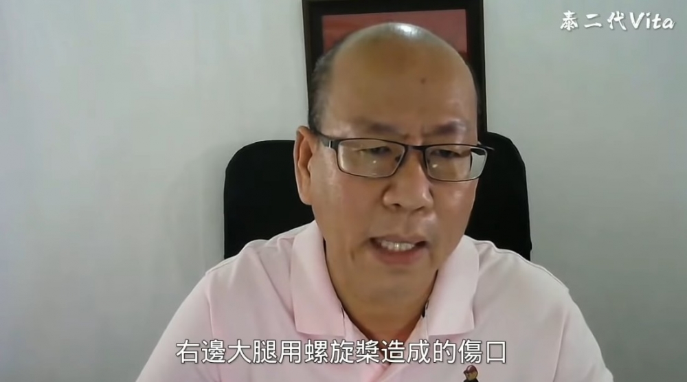 「天才大叔」表示Tangmo右邊大腿嘅傷痕並非由螺旋槳所弄傷