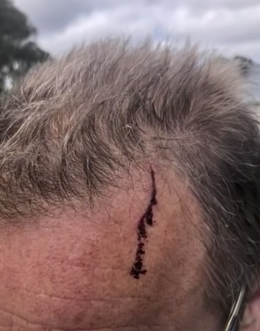 Cliff話袋鼠不斷想抓佢個頭