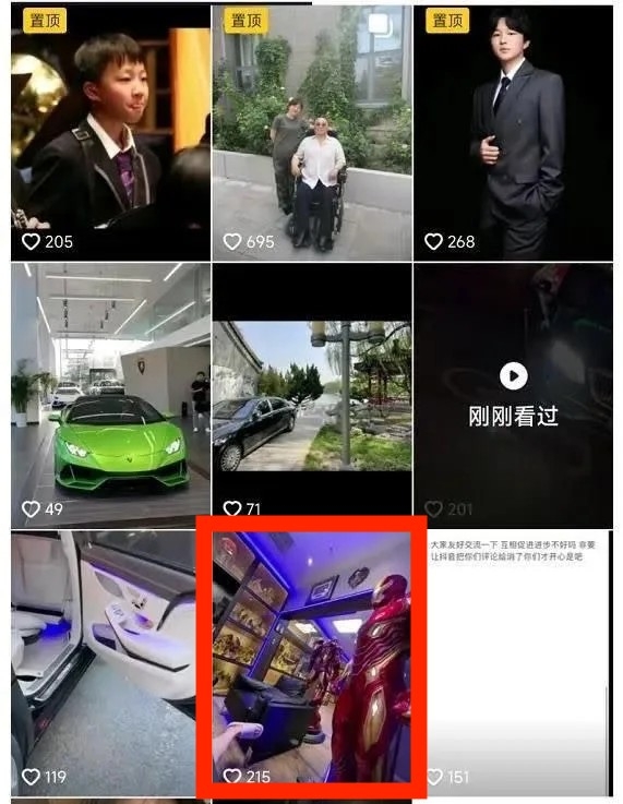 張師嘉仲有收藏模型嘅愛好，佢曾經喺抖音影下自己嘅模型室，入面擺放咗好多玻璃櫃，陳列咗唔少模型，其中最引人目嘅就係2個一比一真人大小嘅「Iron Man」Figure。