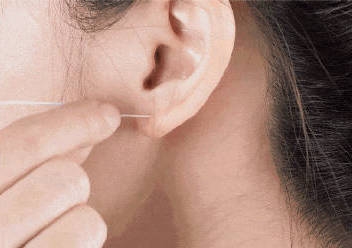 疑商場店舖釘耳窿時冇消毒。