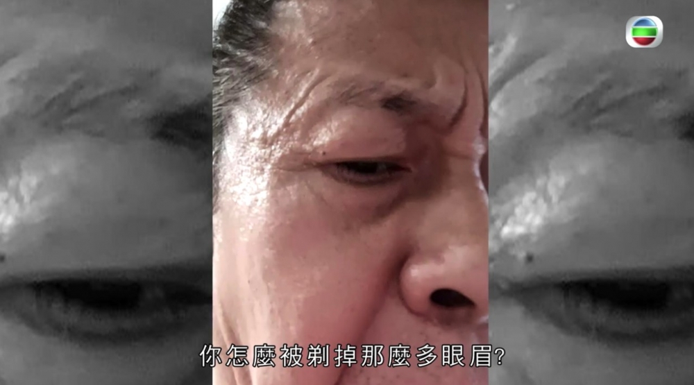 但女兒就驚呼「做咩俾人剃咗咁多眉毛」,嗰時梁先生才驚覺冇咗半條眉!