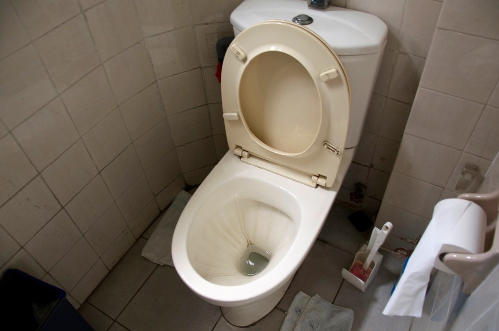 手機背面污糟過廁所板！