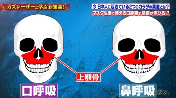 用口呼吸使垂直方向壓力較小,成個臉部睇落都被拉長了,亦會影響上顎骨嘅發育同生長。