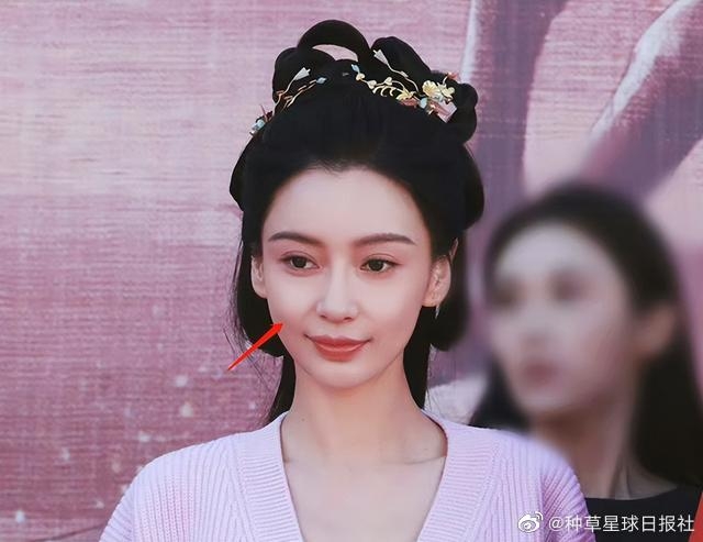 有人認為Baby已經年過30,蘋果肌自然無法同以前比,現時嘅狀態其實好正常