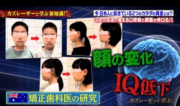 用口呼吸時吸入身體嘅氧氣量相對會減少,容易產生缺氧,甚至IQ低!