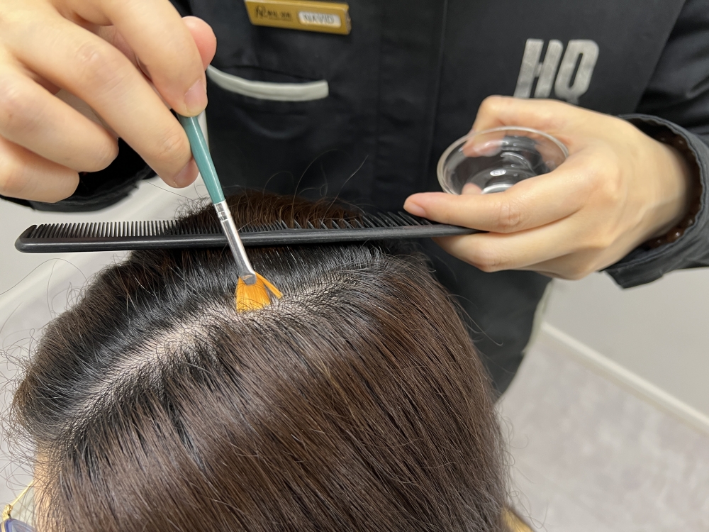 療程後效果明顯，成功強化頭皮，讓頭髮健康生長！