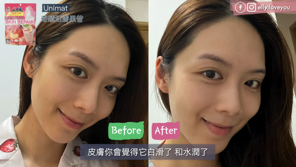 用家艾妮 Elly使用Unimat 後的美顏效果，產品效果因人而異。