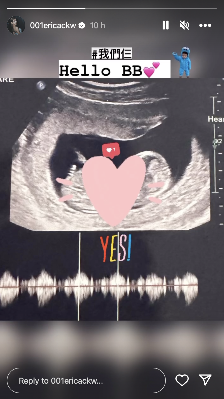 結咗婚近2個月，陳嘉慧就喺IG Story分享超聲波照，宣布懷孕喜訊