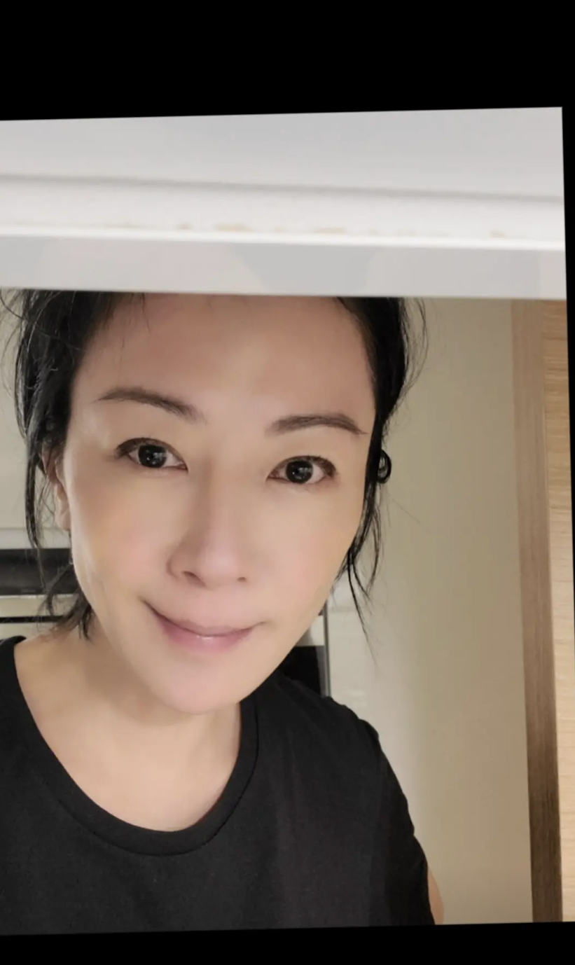 袁潔瑩曾公開承認自己患有焦慮和人群恐懼症、厭食症,導致體重驟降到34公斤。