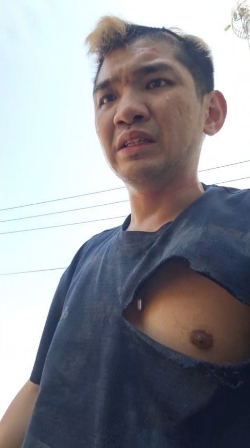 他身上亦出現多處傷口,衣服都被撕爛