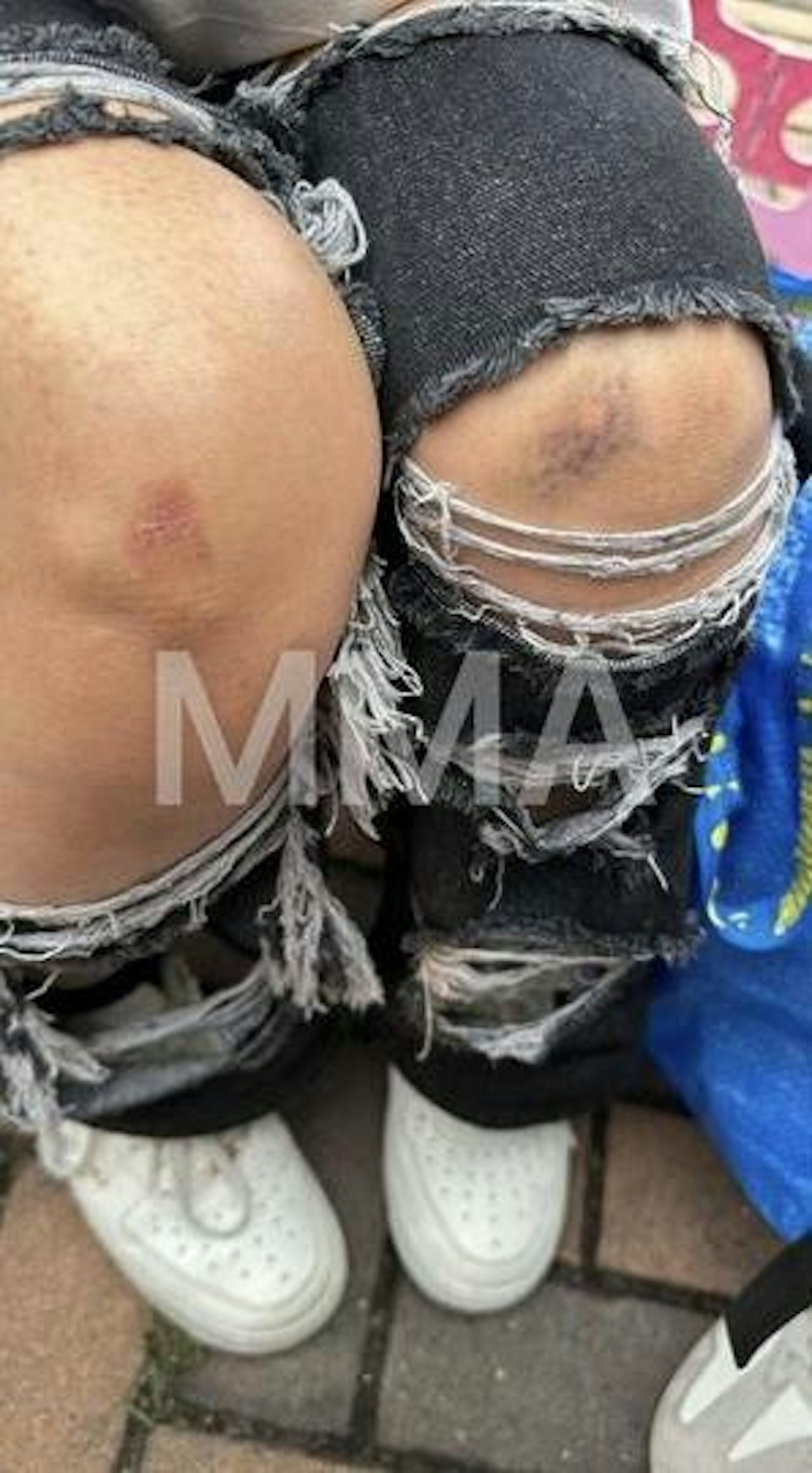 混亂間甚至有人跌倒受傷、擦損手腳