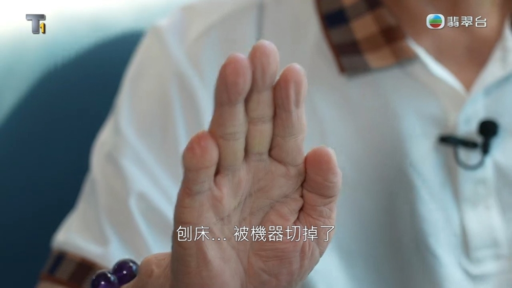 早前網上有人發現原來何伯的右手尾指小了一截,因此就有人傳是何伯年輕時「爛賭」欠債而需要切下手指戒賭