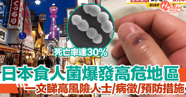 日本食人菌爆發！即睇高危地區、病徵、預防措施、高風險人士