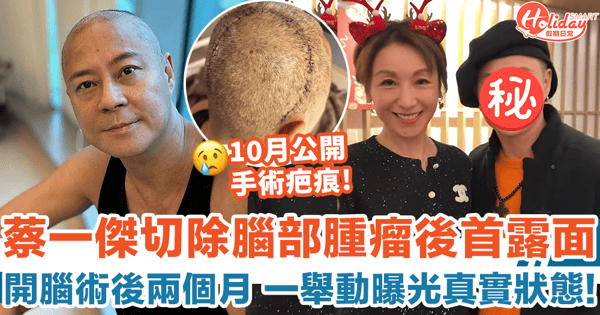 蔡一傑切除腦部腫瘤後首露面 一舉動曝光真實狀態!
