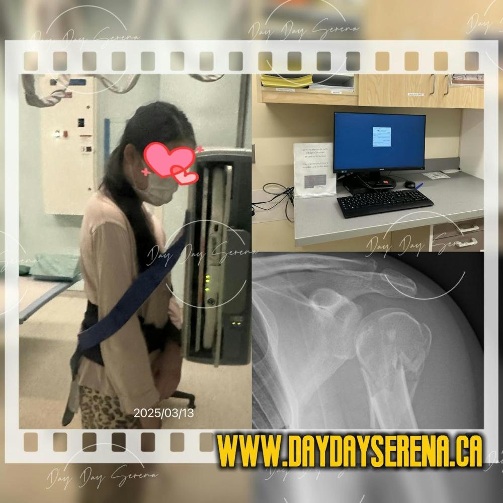 她的大女在Stephy開騷前幾日不小心跌倒造成肩膀骨折