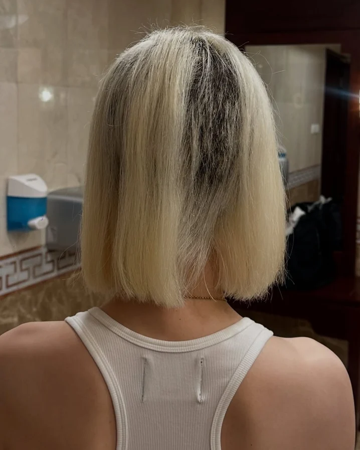 DJ SODA早前在因漂髮失誤令招牌短髮盡毀，髮根全融後腦變禿慘變「鬼剃頭」