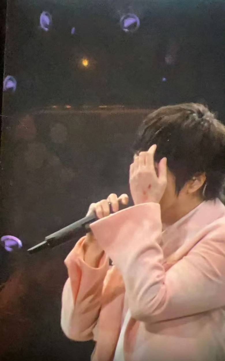 阿信右手上有5個擦傷的血痕