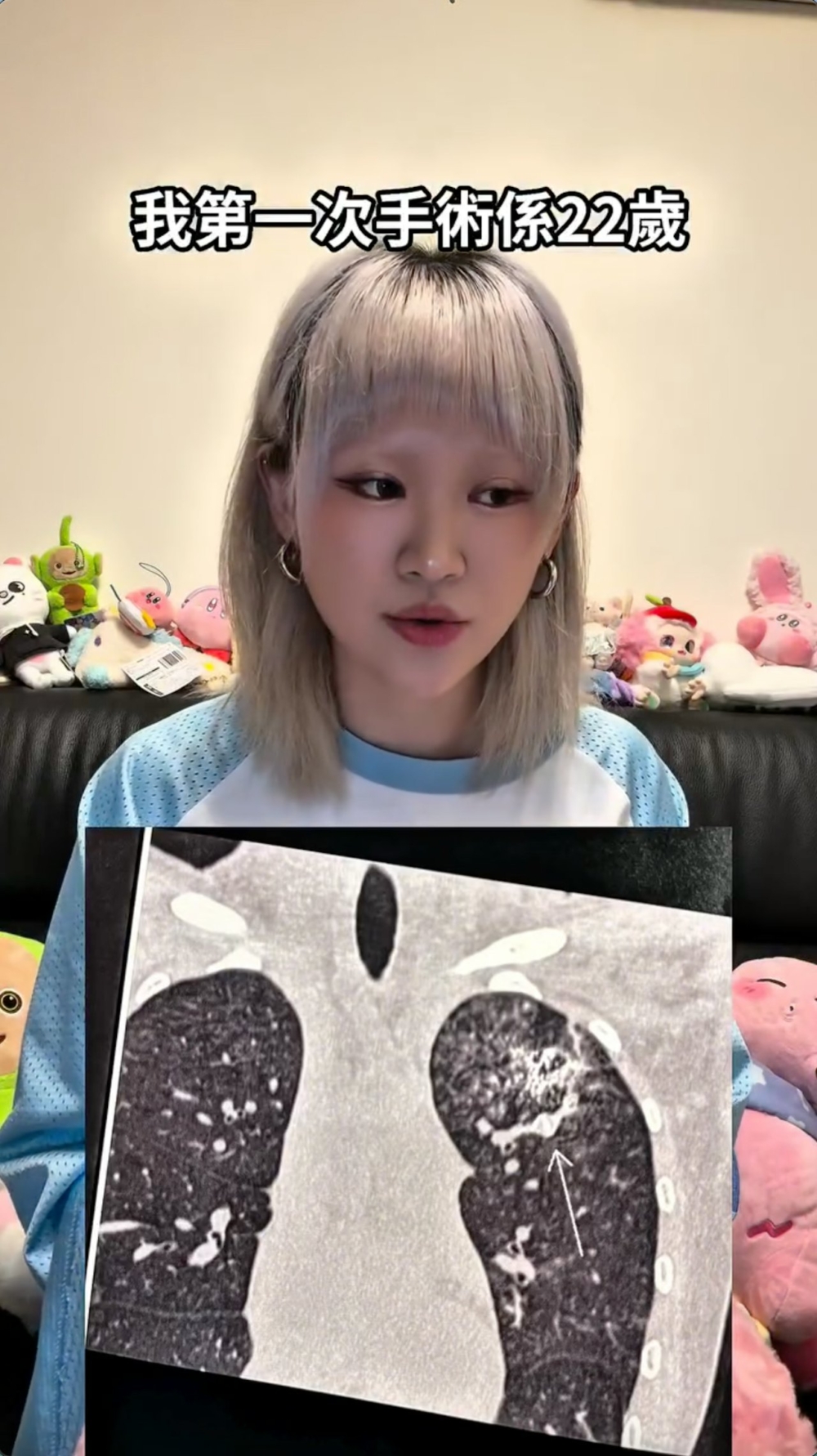 WinWin提到第一次做手術時只有22歲，當時醫生要將金屬螺絲粒放入其血管做阻塞，令血液不會亂流