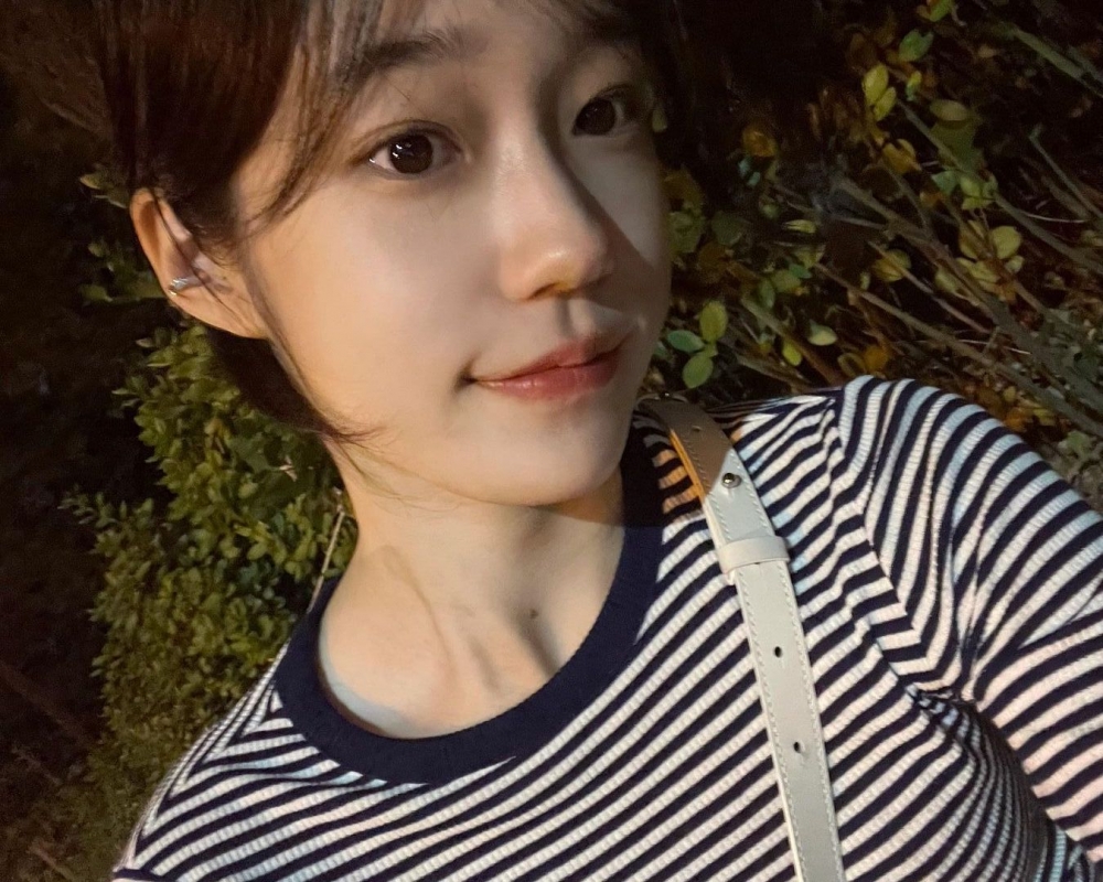 盧允瑞嘴角曾被懷疑整形