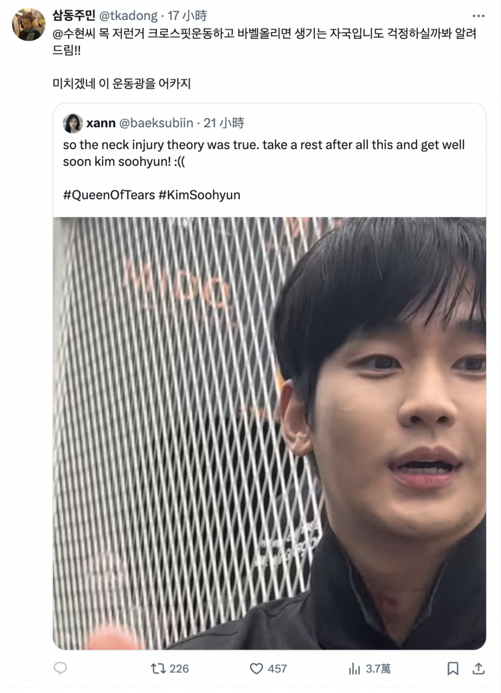 金秀賢被發現脖子上出現瘀青或傷痕