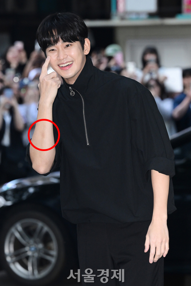 金秀賢手臂上也有瘀青