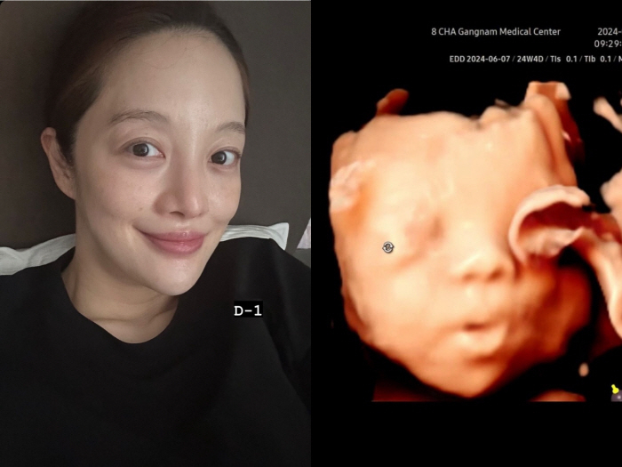 黃寶羅曬寶寶的超音波照