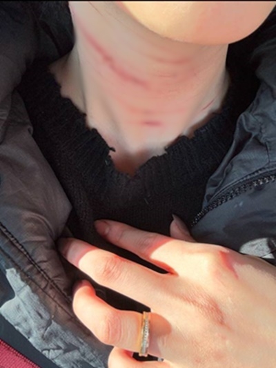 金賽綸向前男友發送被家暴的證據