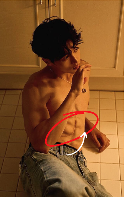 肝臟移植手術留下的疤痕