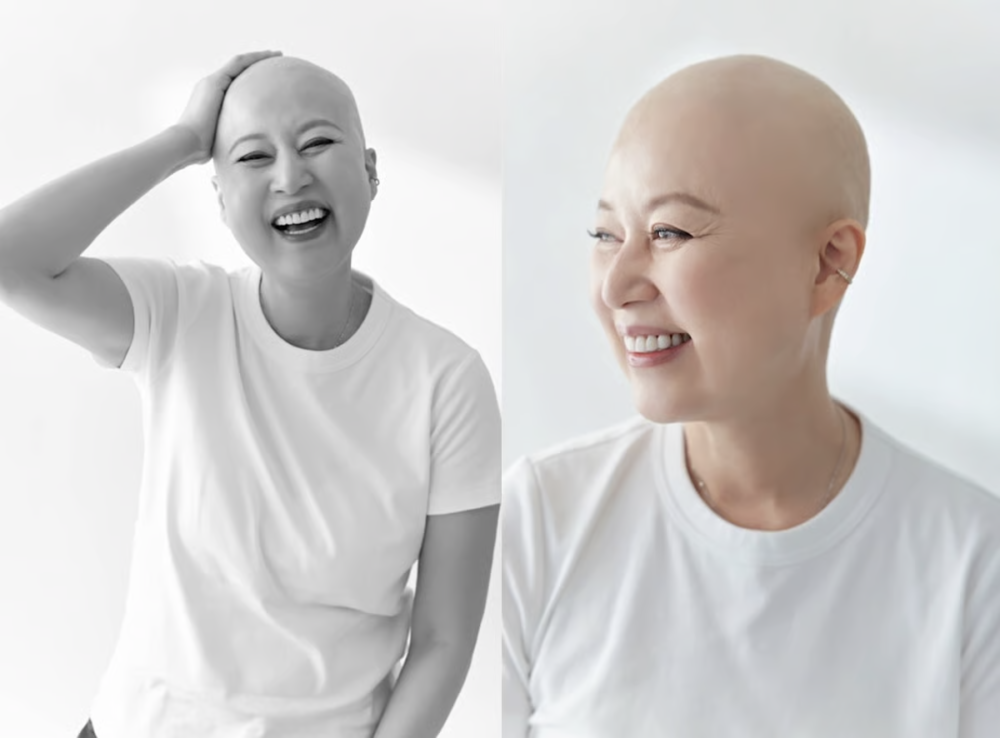 朴美善拍攝光頭形象照