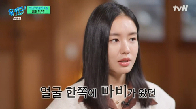 壓力過大一度罹患面癱