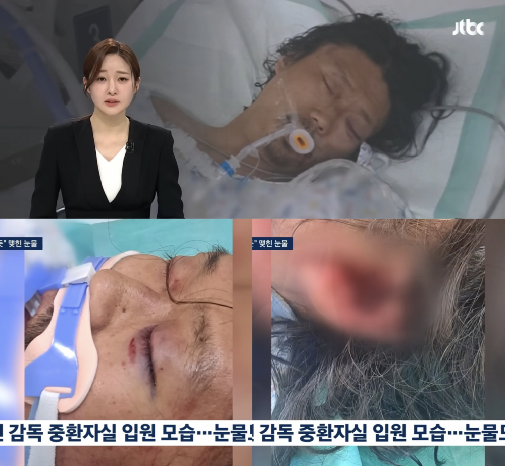 金昌民導演送醫時的傷勢