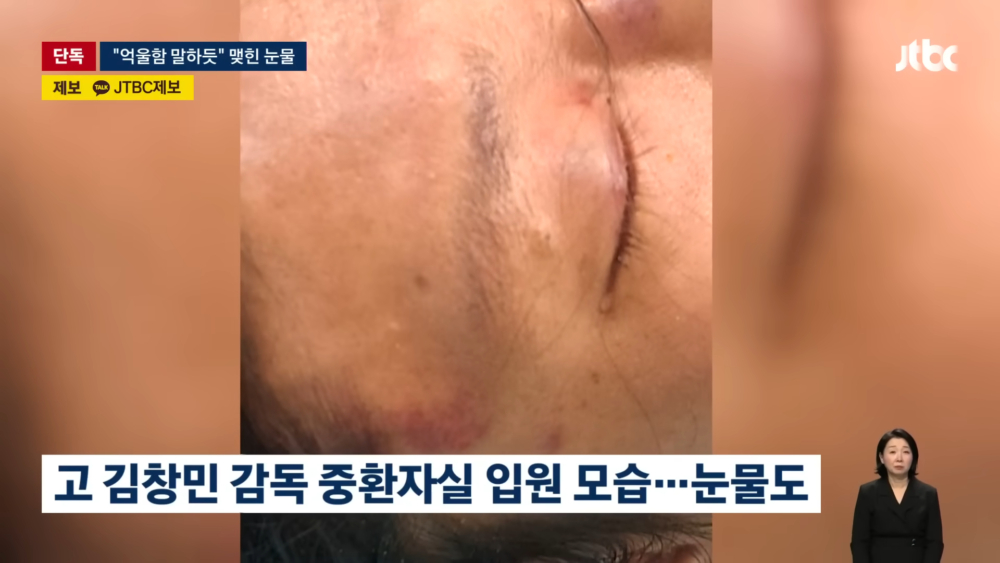 金昌民導演重傷昏迷期間留下眼淚