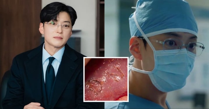 張勝祖《Doctor X》演變態醫生IG急道歉!「肝臟刻字」竟是真實案例